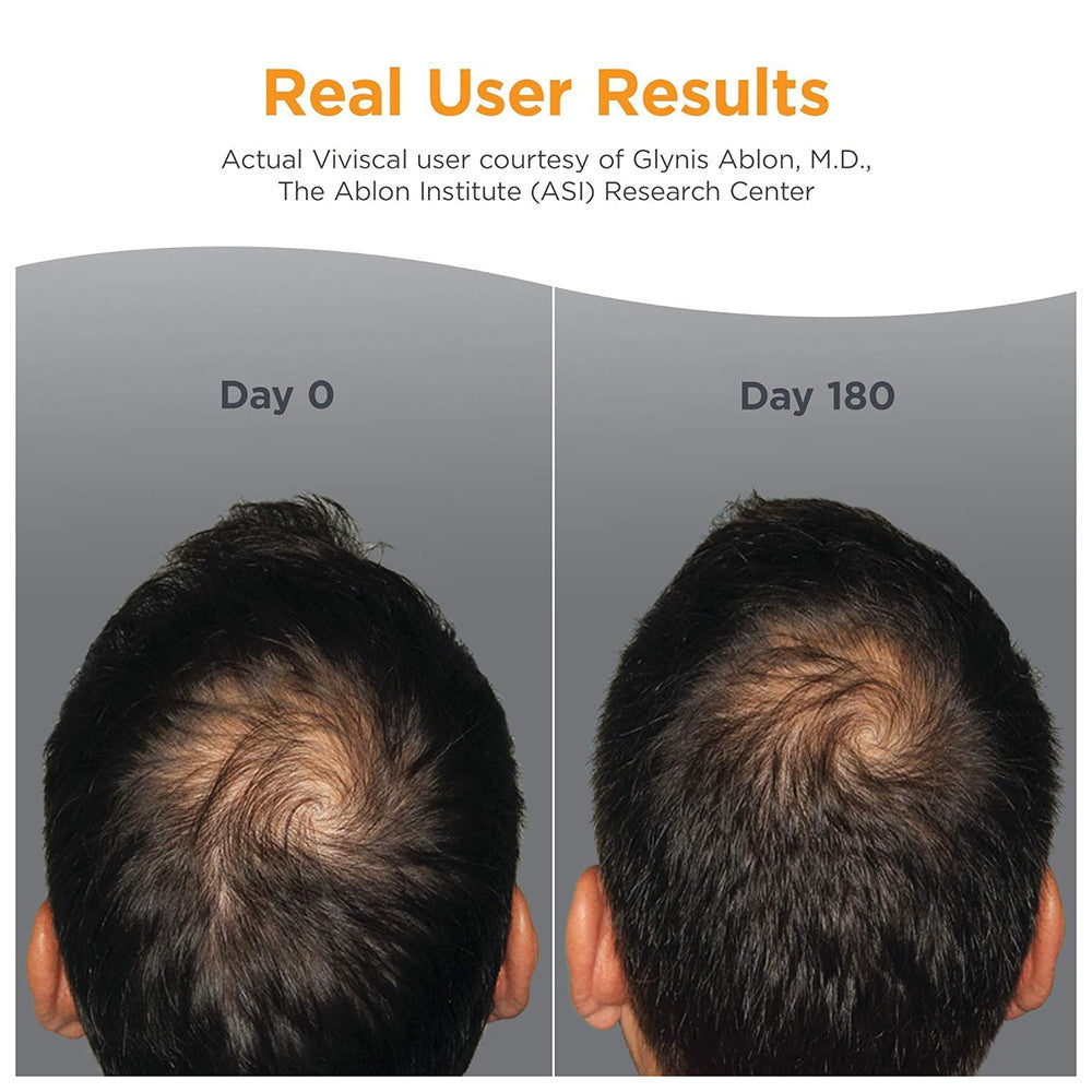 Viviscal Men Advance Nourishing Thining Hair and Hair Growth Supplement Tablets, 60 Ea