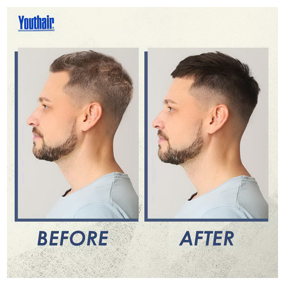 Youthair with Hair Conditioner & Groomer Liquid For Men, 8 Oz