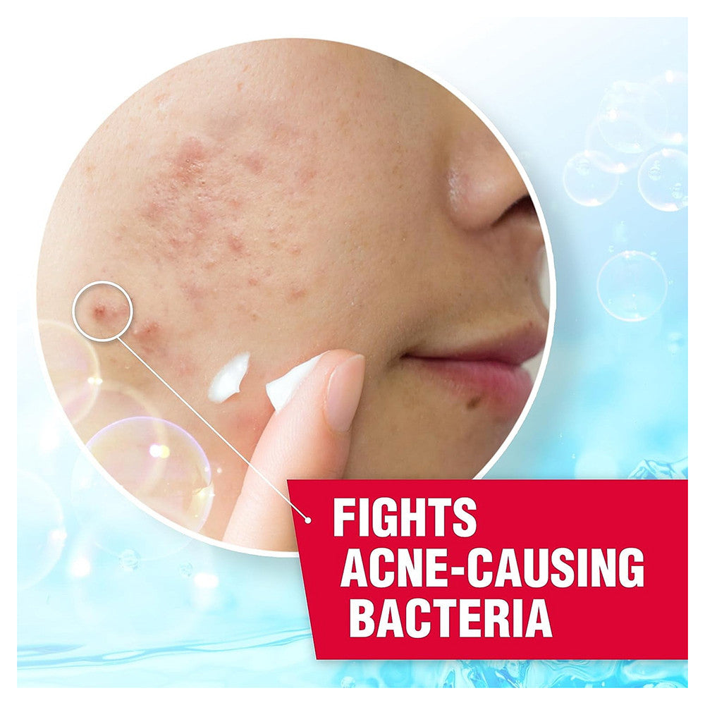 Asepxia Acne Spot Treatment Cream with 10% Benzoyl Peroxide for Pimples and Blackhead, 1 Oz