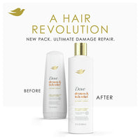 Dove Beauty Dermacare Anti Dandruff Conditioner, 12 Oz