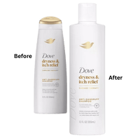 Dove Beauty DermaCare Anti Dandruff Shampoo for Scalp Dryness and Itch Relief, 12 Oz