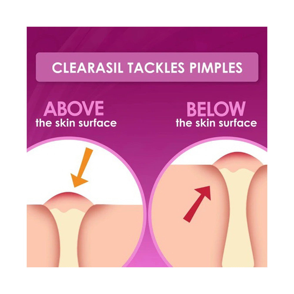 Clearasil Ultra Overnight Acne Spot Patches, 18 Ea